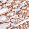 Anti-CAIX Rabbit Monoclonal Antibody