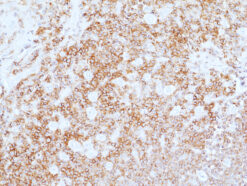 Anti-CD45 Rabbit Monoclonal Antibody