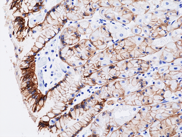 Anti-CLDN 18.2 Rabbit Monoclonal Antibody